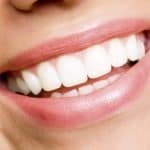 teeth whitening - hoover alabama dental clinic